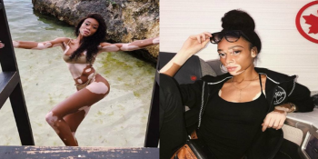 Winnie Harlow e a nova era da beleza: quando a moda abraça a diversidade